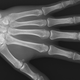 Illustration for article titled Simulation May Finally Explain Why Knuckle Cracking Makes That Awful Sound